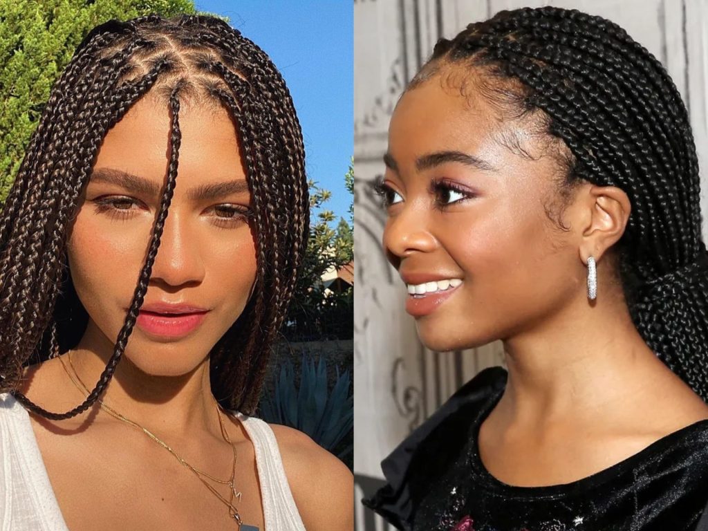 Dreamy hair loss cover styles